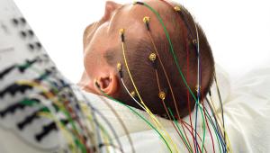 EEG - Electroencephalography